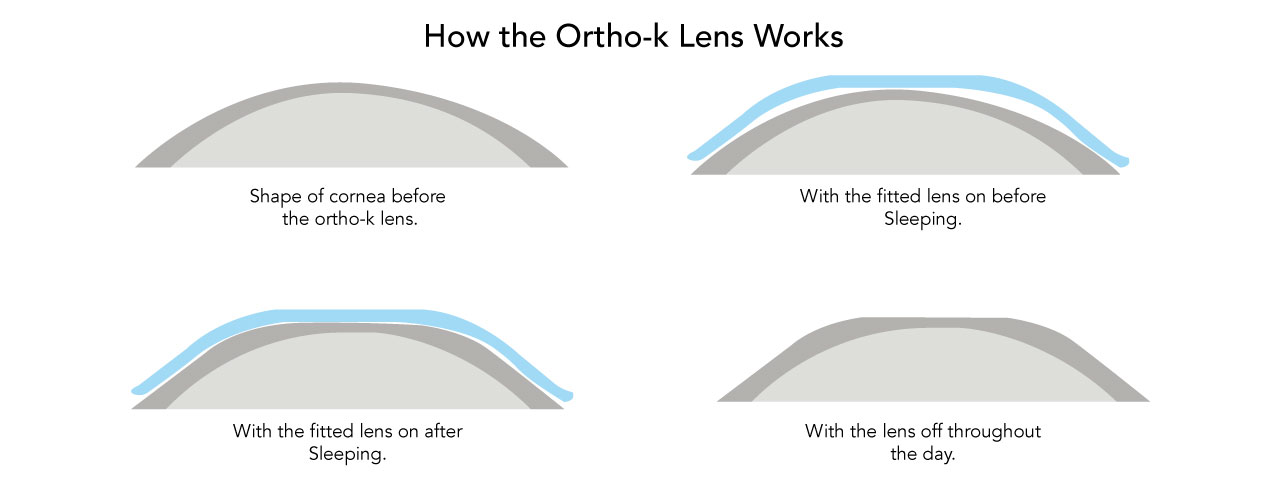 how orthokworks