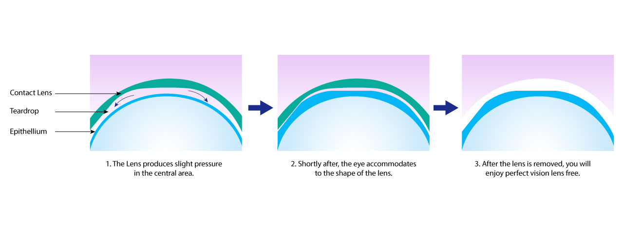 orthok for treatment